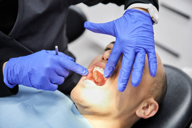 Best Emergency Wisdom Teeth Removal in Bent Creek, NC